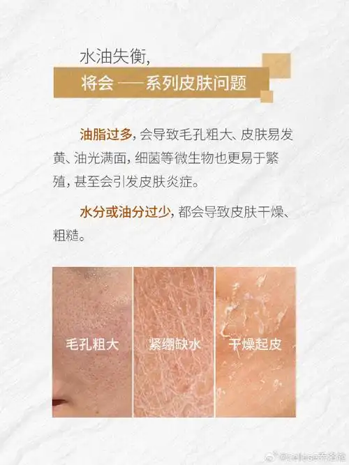 凯芙兰BB霜是不是特油还是我皮肤太油了每次用的都油光发亮