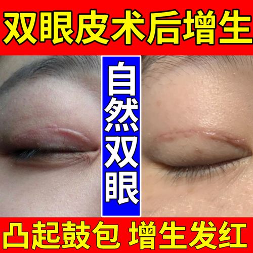 眼角疤痕用什么遮瑕